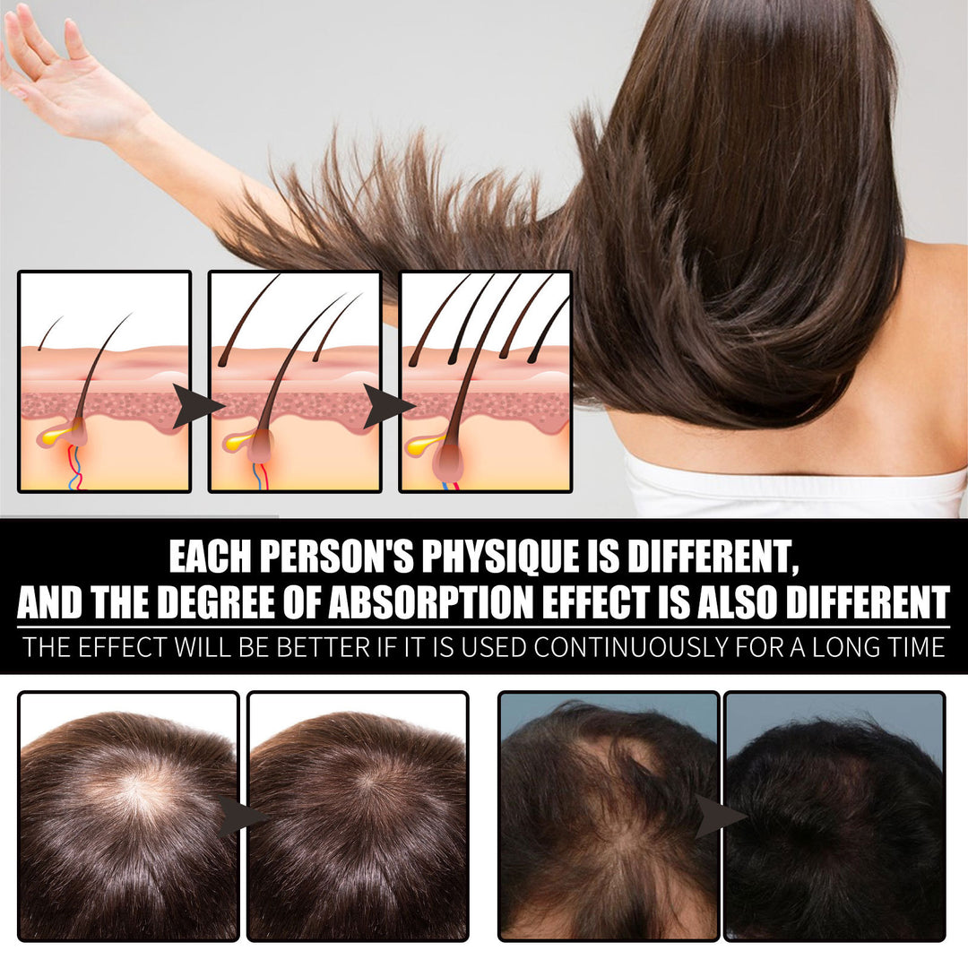 RESEARCH Liquid Biotin & Collagen Hair Growth Drops  - Biotin And Liquid Collagen Supplement For Men & Women - Glowing Skin Support, Healthy Hair & Nail Growth