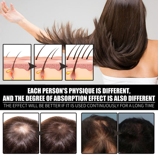RESEARCH Liquid Biotin & Collagen Hair Growth Drops  - Biotin And Liquid Collagen Supplement For Men & Women - Glowing Skin Support, Healthy Hair & Nail Growth